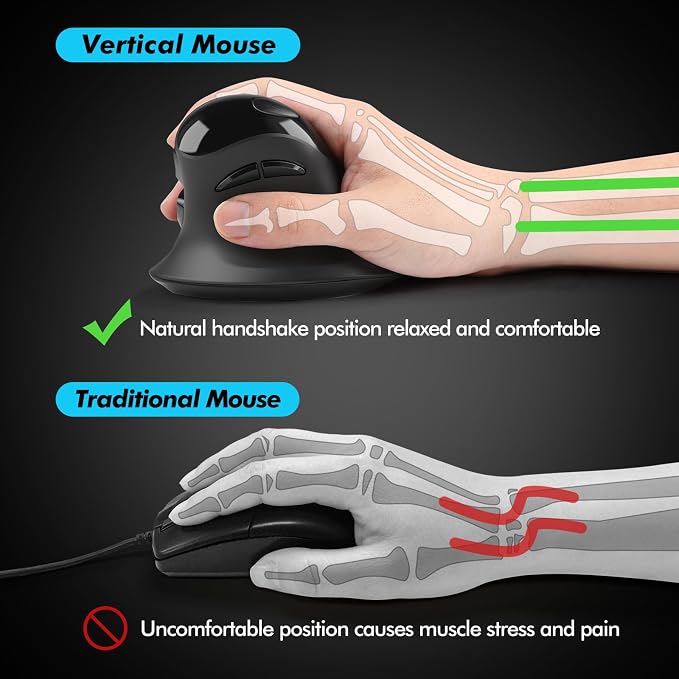 MicroPack Ergonomic Mouse, Vertical Wireless Mouse with USB A & Type-C Receiver, Ergo Design Reduces Muscle Strain, 6 Buttons 800/1200/1600 DPI Mouse for Windows, Mac, PC, Laptop, Black